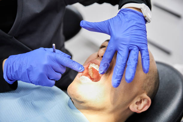 Best Chipped Tooth Repair Near Me  in Broomfield, CO